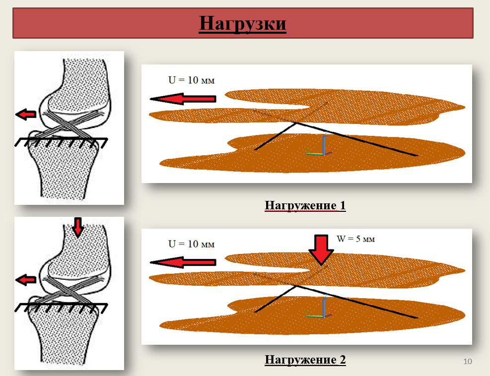 Применение программного комплекса ЛИРА-САПР для оценки усилий в передней крестообразной связке коленного сустава